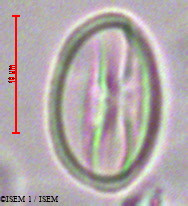 ISEM 1/Weinmannia_trichosperma_28579/Weinmannia_trichosperma_28579_0003(copy).jpg